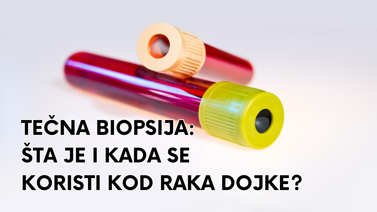 Tečna biopsija: Šta je i kada se koristi kod raka dojke?