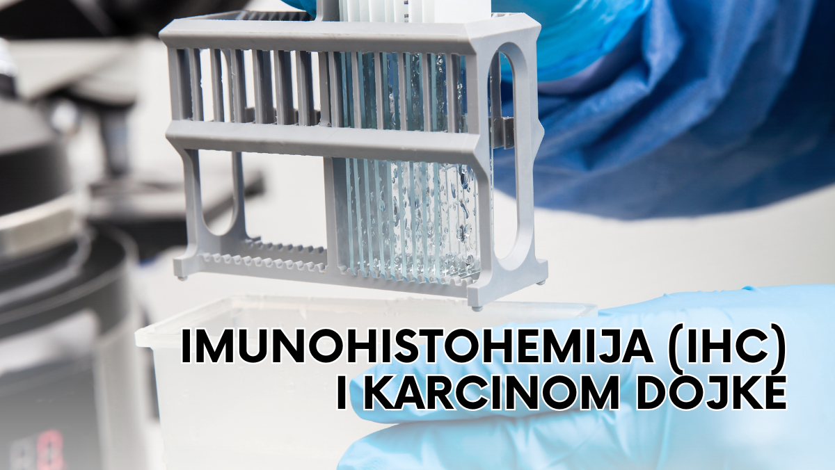 Imunohistohemija (IHC) i karcinom dojke