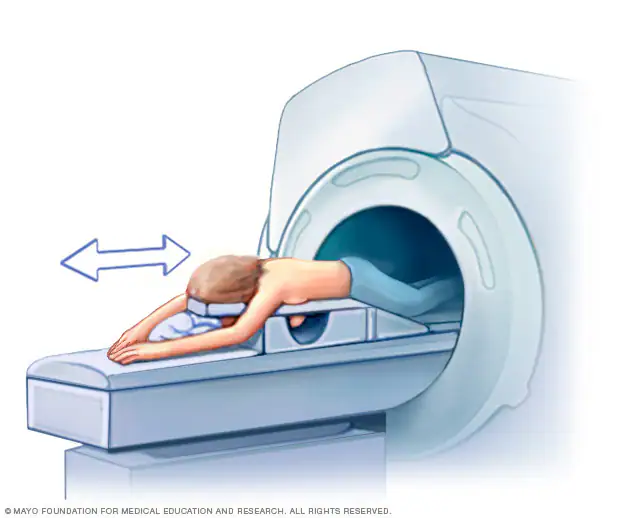 MRI dojki