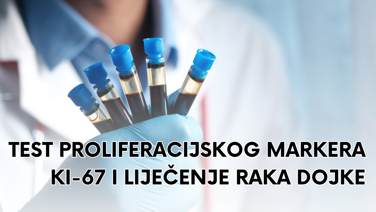 Test proliferacijskog markera Ki-67 i liječenje raka dojke