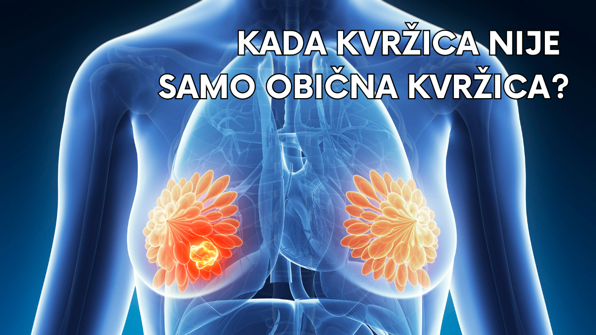 Kada kvržica nije samo obična kvržica?