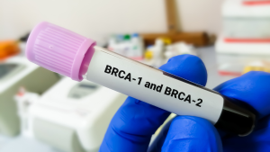 brca 1 brca 2