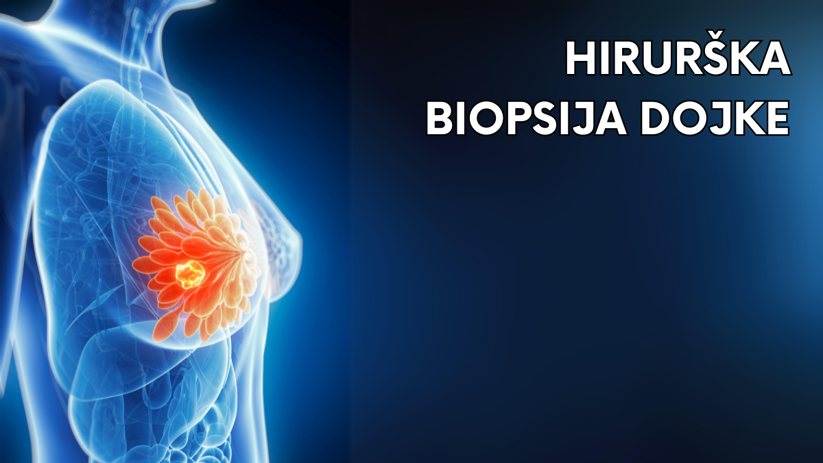 Hirurška biopsija dojke