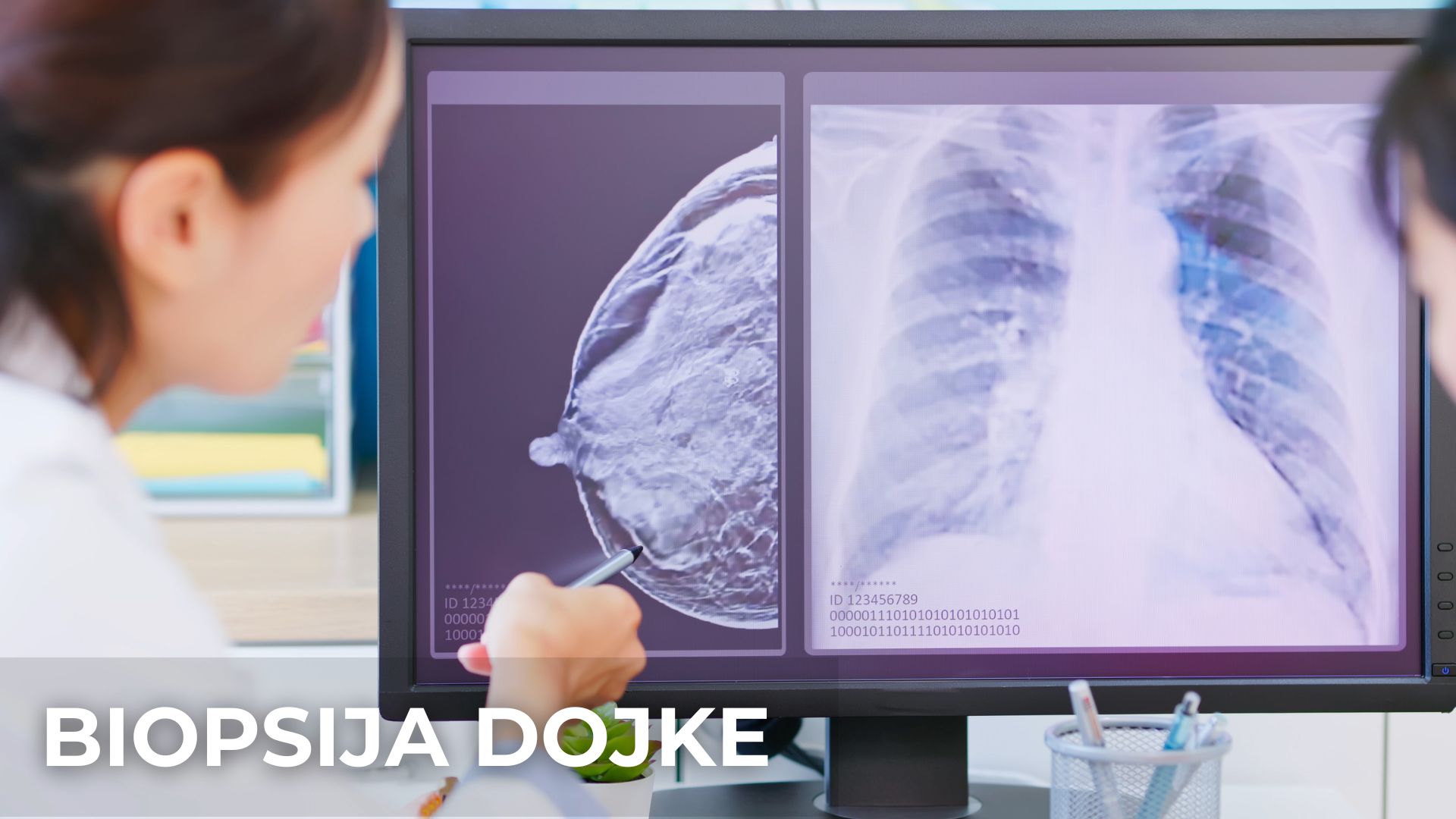 Biopsija dojke