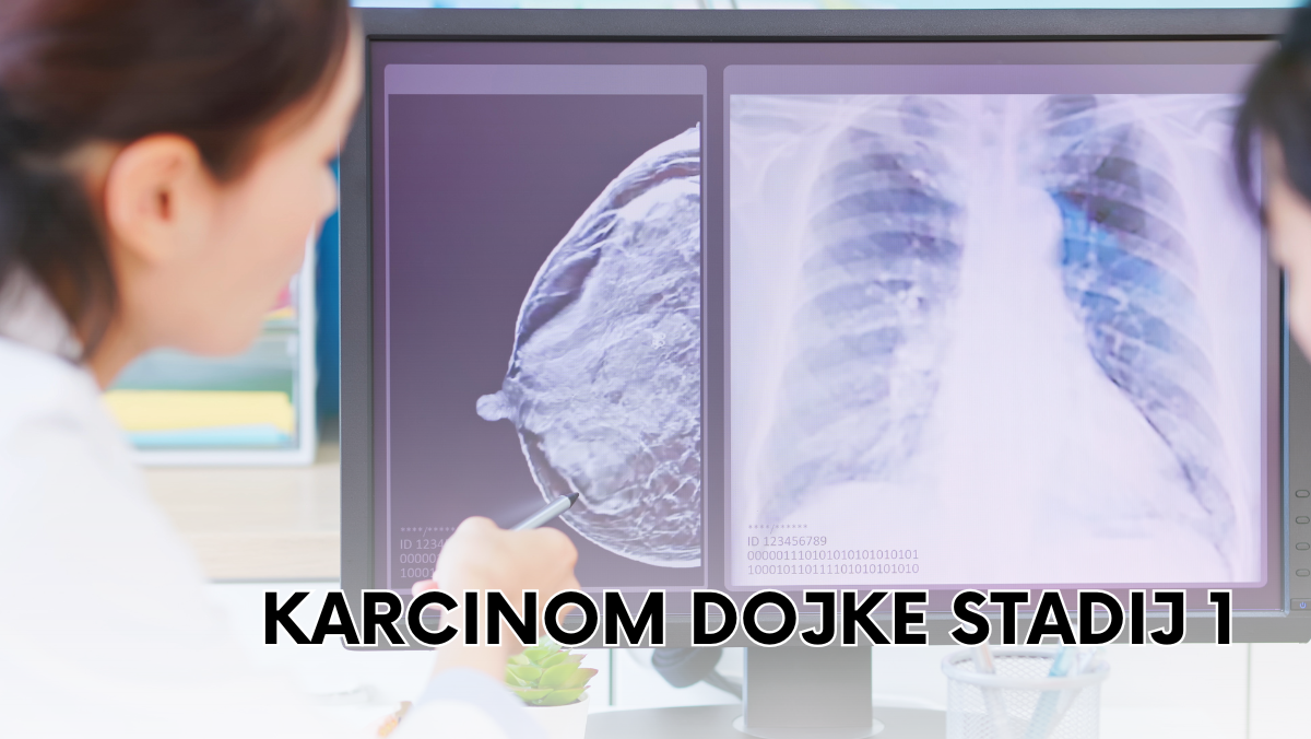 Karcinom dojke stadij 1